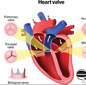 Cardiac surgery in patients with severe valvular and coronary heart disease.